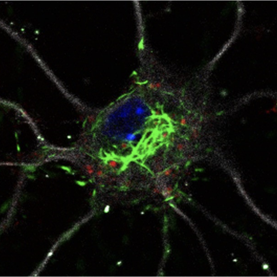 alpha-synuclein strain